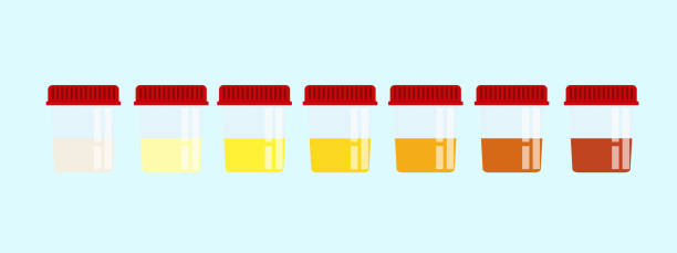 Summer Hydration Tips: What Your Urine Can Tell You